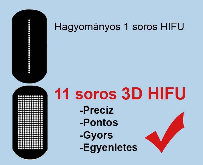 Maximális lövésszám, minimális beavatkozási idő, érezhető eredmények!